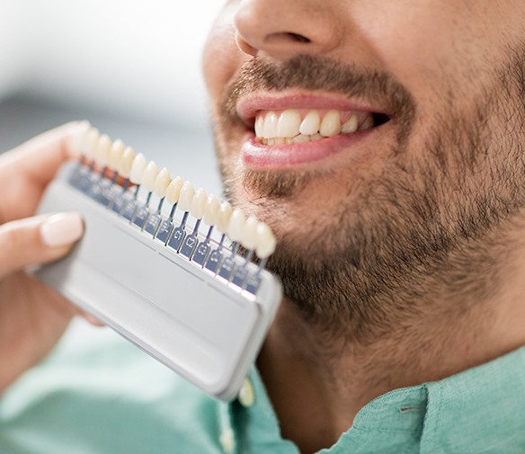 Man's smile compared with porcelain veneer shade chart