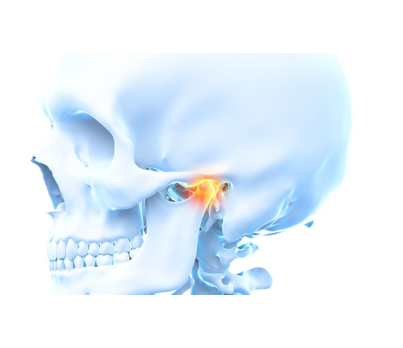 Model of skull with TMJ highlighted